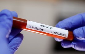 ШҚО коронавирус инфекциясының ағымдағы жағдайы туралы
