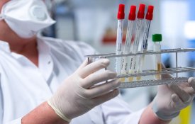 Предварительные результаты выявили мутацию вируса и показали, что она характерна для «Дельта» штамма